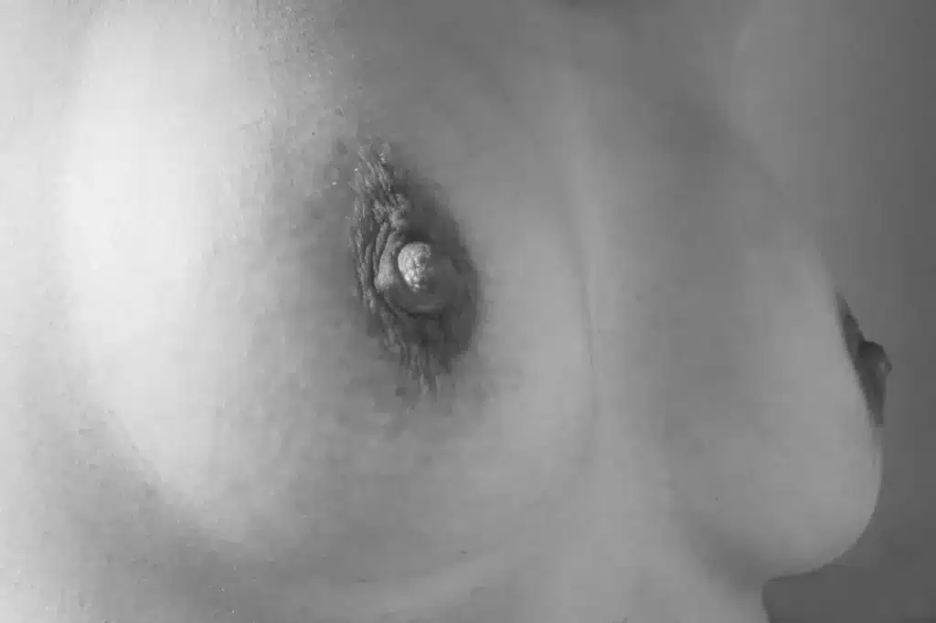 Câncer de Mama plano de saúde Unimed Bradesco SulAmérica www.planosdesaudeecia.com.br