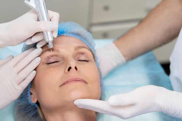 Blefaroplastia Principais Benefícios a Estética